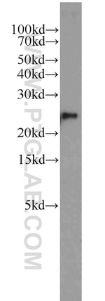 PSMB2 Antibody in Western Blot (WB)