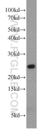 PSMB2 Antibody in Western Blot (WB)
