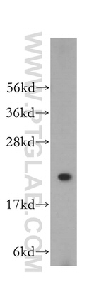 PSMB2 Antibody in Western Blot (WB)