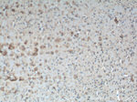 SFXN3 Antibody in Immunohistochemistry (Paraffin) (IHC (P))