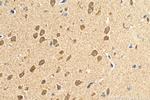 SFXN3 Antibody in Immunohistochemistry (Paraffin) (IHC (P))