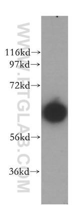 PGM1 Antibody in Western Blot (WB)