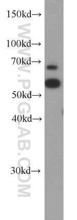 SARS Antibody in Western Blot (WB)