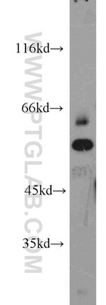SARS Antibody in Western Blot (WB)