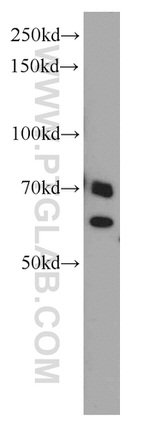 SARS Antibody in Western Blot (WB)