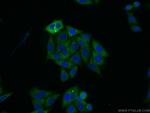 SARS Antibody in Immunocytochemistry (ICC/IF)