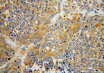 SARS Antibody in Immunohistochemistry (Paraffin) (IHC (P))