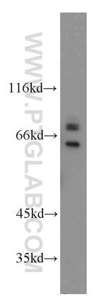 SARS Antibody in Western Blot (WB)