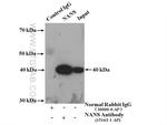 NANS Antibody in Immunoprecipitation (IP)
