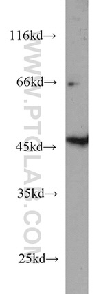 GALK2 Antibody in Western Blot (WB)