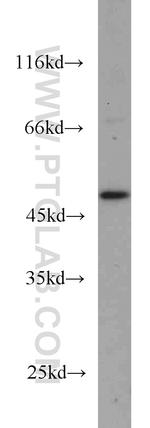 GALK2 Antibody in Western Blot (WB)