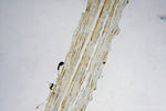 FEM1A Antibody in Immunohistochemistry (Paraffin) (IHC (P))