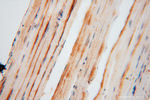 FEM1A Antibody in Immunohistochemistry (Paraffin) (IHC (P))