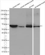 CRAT Antibody in Western Blot (WB)
