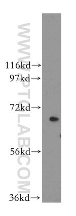 CRAT Antibody in Western Blot (WB)