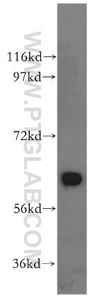 GPI Antibody in Western Blot (WB)