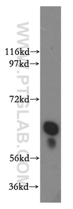 GPI Antibody in Western Blot (WB)