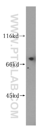 Retrolinkin Antibody in Western Blot (WB)