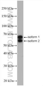 Retrolinkin Antibody in Western Blot (WB)