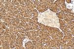 RPL34 Antibody in Immunohistochemistry (Paraffin) (IHC (P))