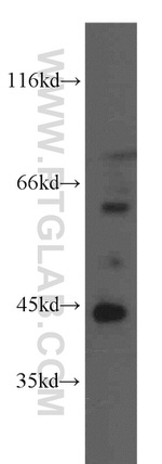 CA12 Antibody in Western Blot (WB)