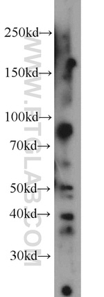 CA12 Antibody in Western Blot (WB)