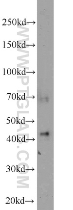 CA12 Antibody in Western Blot (WB)