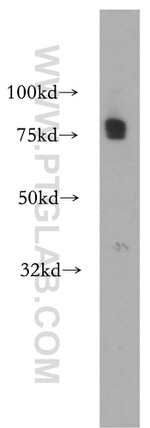 CA12 Antibody in Western Blot (WB)