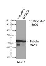 CA12 Antibody in Western Blot (WB)