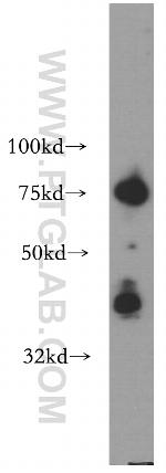 CA12 Antibody in Western Blot (WB)