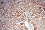 NDUFAF1 Antibody in Immunohistochemistry (Paraffin) (IHC (P))