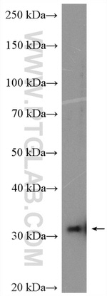 NDUFAF1 Antibody in Western Blot (WB)