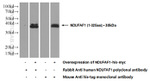 NDUFAF1 Antibody in Western Blot (WB)