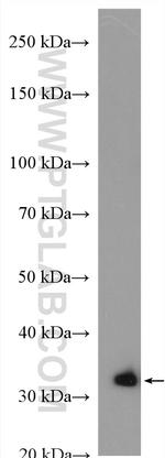 NDUFAF1 Antibody in Western Blot (WB)