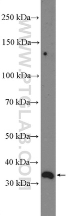 NDUFAF1 Antibody in Western Blot (WB)