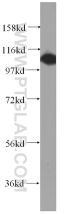 NLRP2 Antibody in Western Blot (WB)