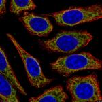CPT1A Antibody in Immunocytochemistry (ICC/IF)