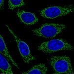 CPT1A Antibody in Immunocytochemistry (ICC/IF)