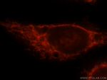 CPT1A Antibody in Immunocytochemistry (ICC/IF)