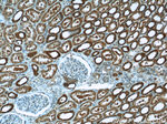 CPT1A Antibody in Immunohistochemistry (Paraffin) (IHC (P))