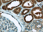 CPT1A Antibody in Immunohistochemistry (Paraffin) (IHC (P))