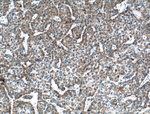 CPT1A Antibody in Immunohistochemistry (Paraffin) (IHC (P))