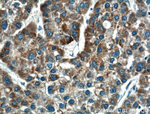 CPT1A Antibody in Immunohistochemistry (Paraffin) (IHC (P))