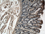 CPT1A Antibody in Immunohistochemistry (Paraffin) (IHC (P))