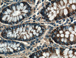 CPT1A Antibody in Immunohistochemistry (Paraffin) (IHC (P))