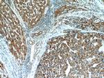 CPT1A Antibody in Immunohistochemistry (Paraffin) (IHC (P))