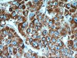 CPT1A Antibody in Immunohistochemistry (Paraffin) (IHC (P))