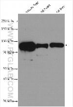 CPT1A Antibody in Western Blot (WB)