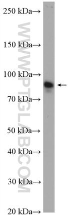 CPT1A Antibody in Western Blot (WB)