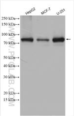 CPT1A Antibody in Western Blot (WB)
